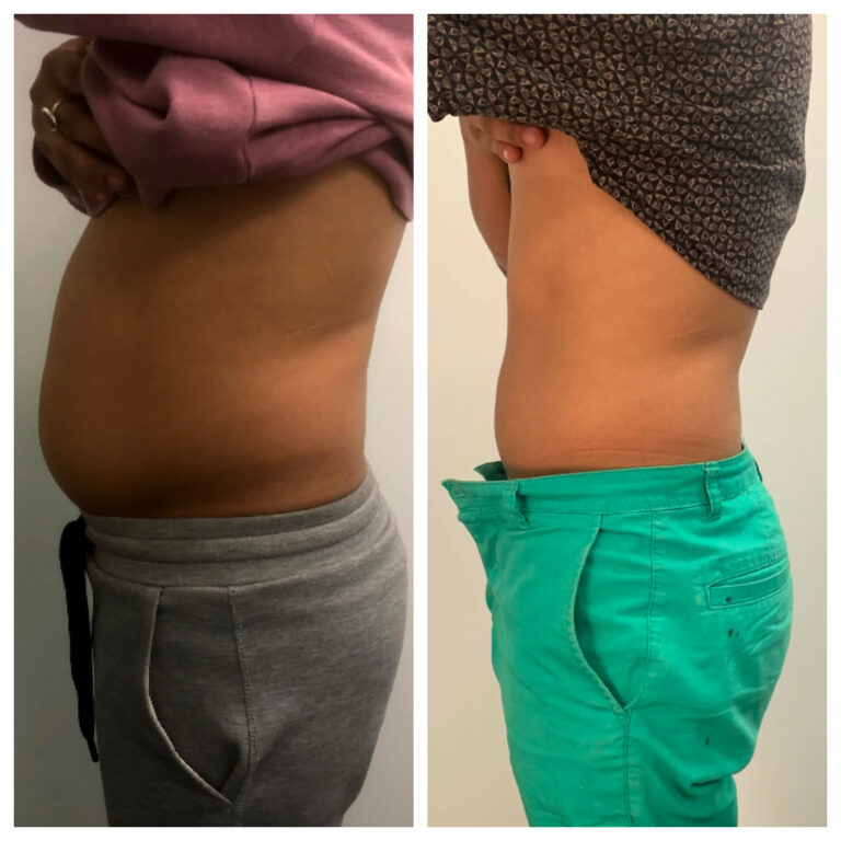 8-slimming-sessions-give-credit-to-@thrivecryostudio